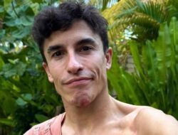 Cedera Marc Marquez Bikin Heboh, Dokter Temukan Sekrup Bengkok yang Mungkin Merusak Karier!